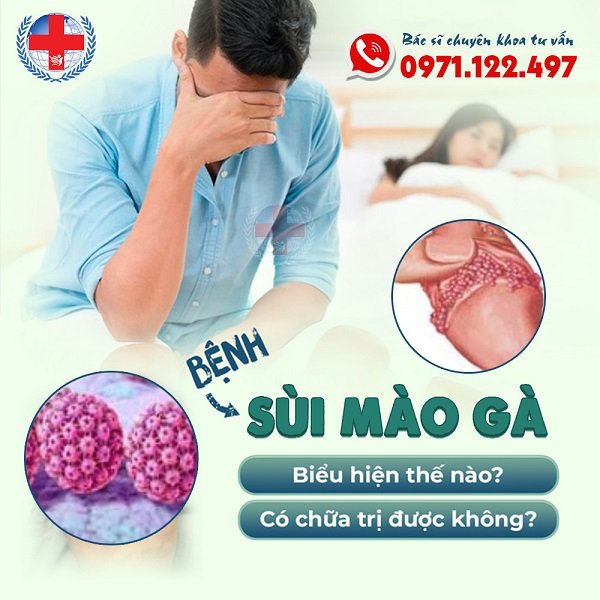 chữa sùi mào gà dứt điểm