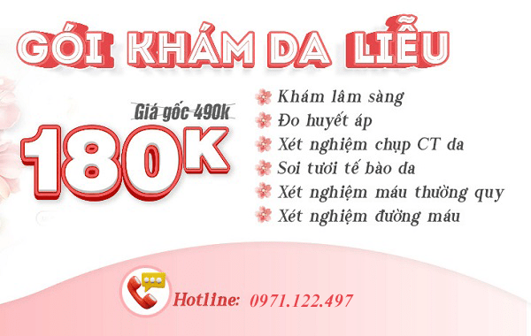 chữa hắc lào tại Nông Trang, Việt Trì