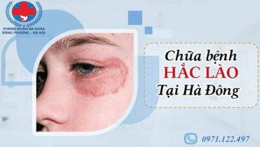 chữa hắc lào tại Hà Đông