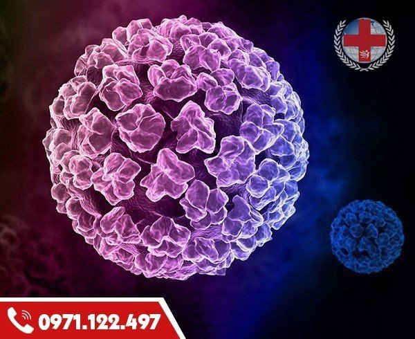 chữa sùi mào gà dứt điểm