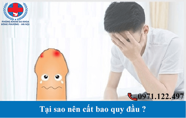 Không cắt bao quy đầu