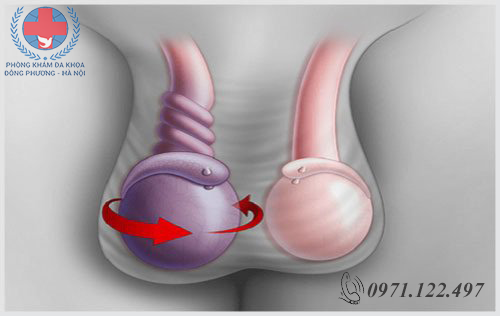địa chỉ chữa đau tinh hoàn 