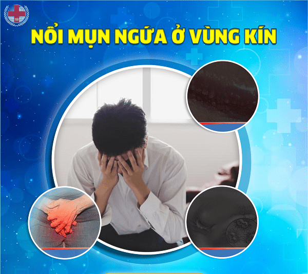 nổi mụn ở vùng kín nam có sao không