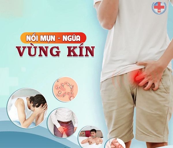 Nổi mụn vùng kín nam