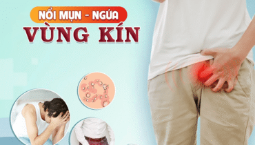 Nổi mụn vùng kín nam có sao không?