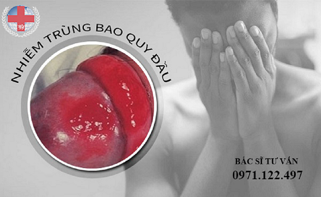 Nhiễm Trùng Bao Quy Đầu Và Cách Điều Trị