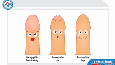Dài bao quy đầu có nguy hiểm không