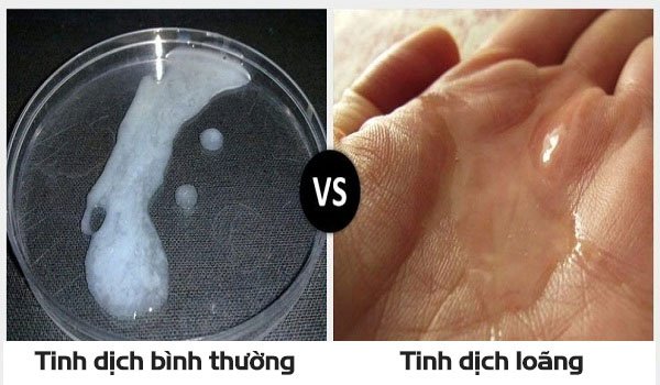 dấu hiệu tinh trùng yếu