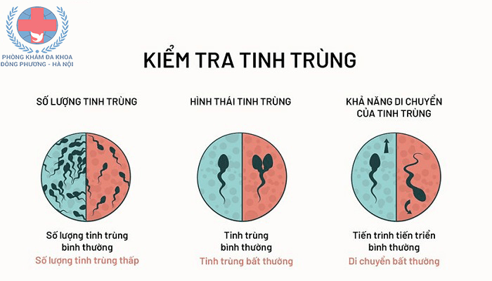 chữa vô sinh ở nam uy tín