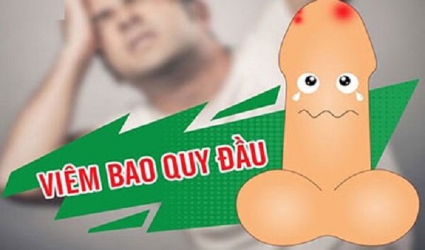 chữa viêm bao quy đầu uy tín