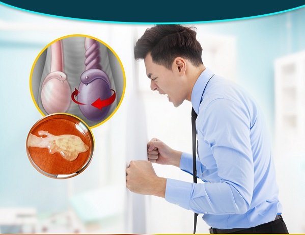 chữa viêm bao quy đầu uy tín