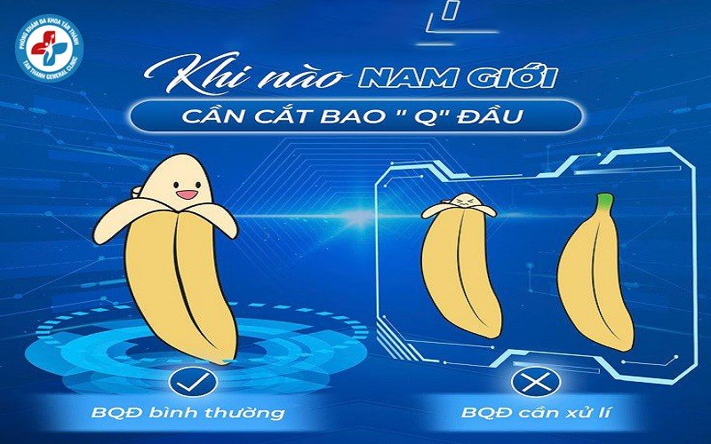 Khi nào nam giới cần cắt bao quy đầu