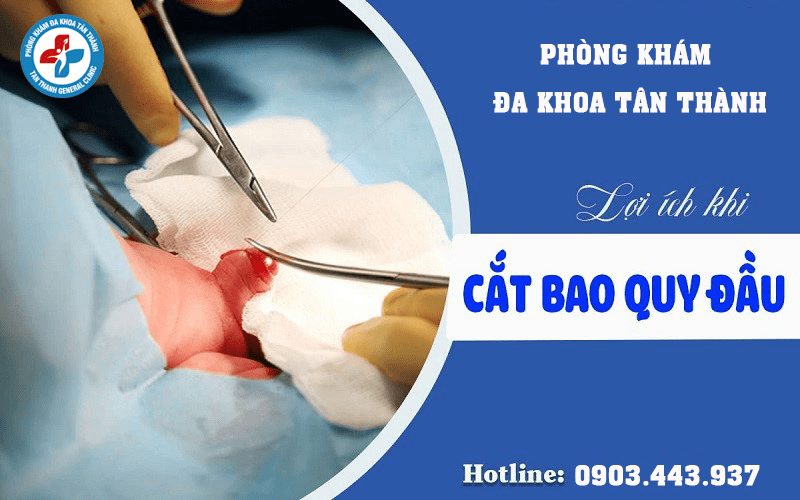 Cắt bao quy đầu 